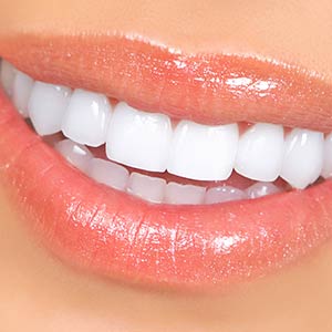 Whitening